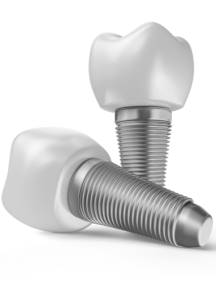 Dental Implant Marketing​